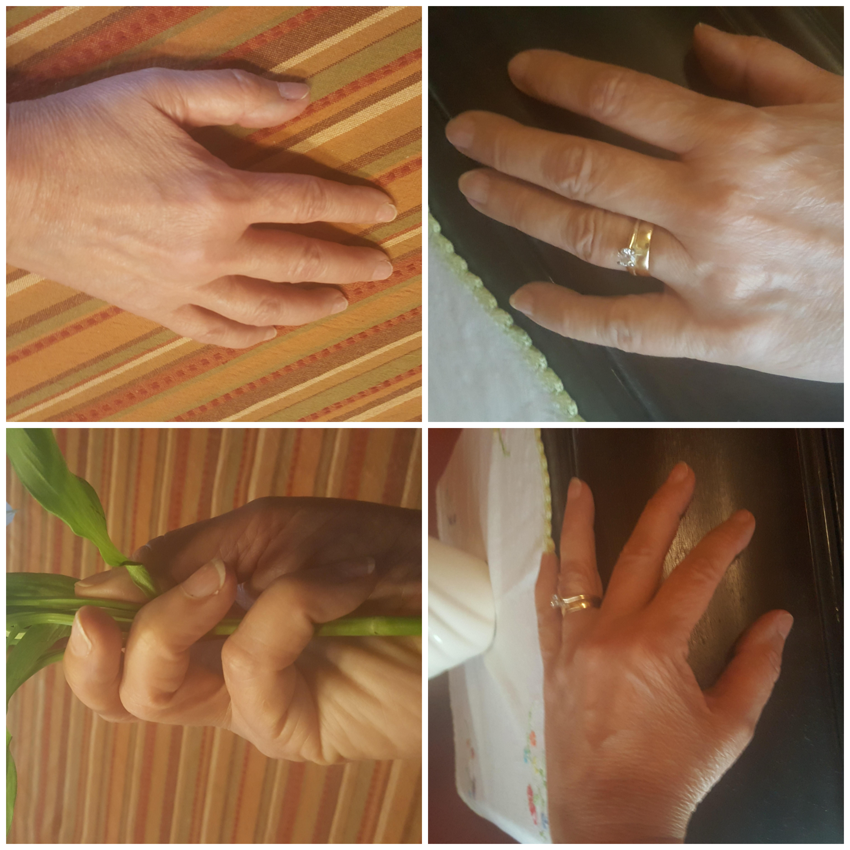 Hand Image